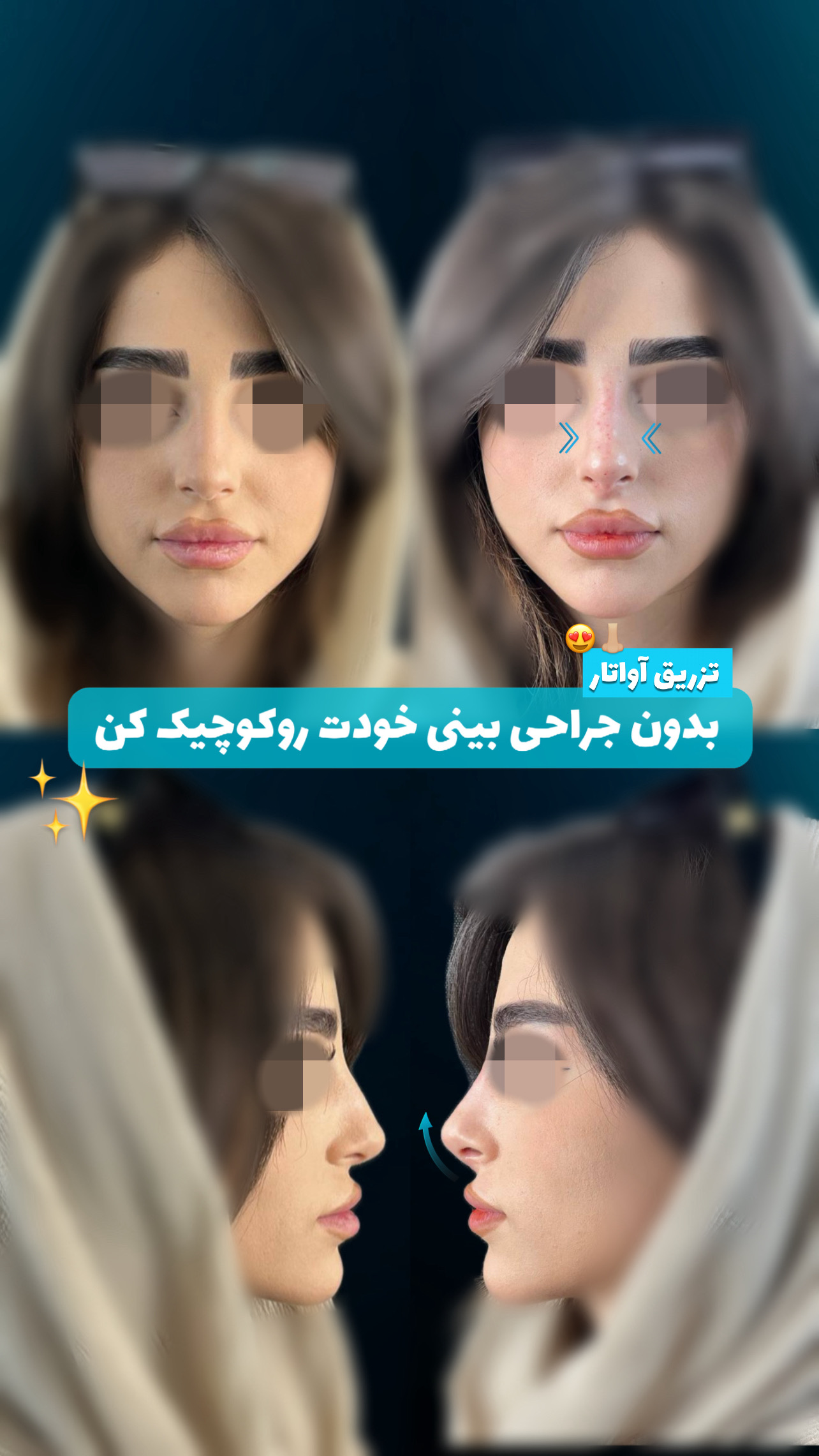 گالری آواتار بینی - تصویر 16