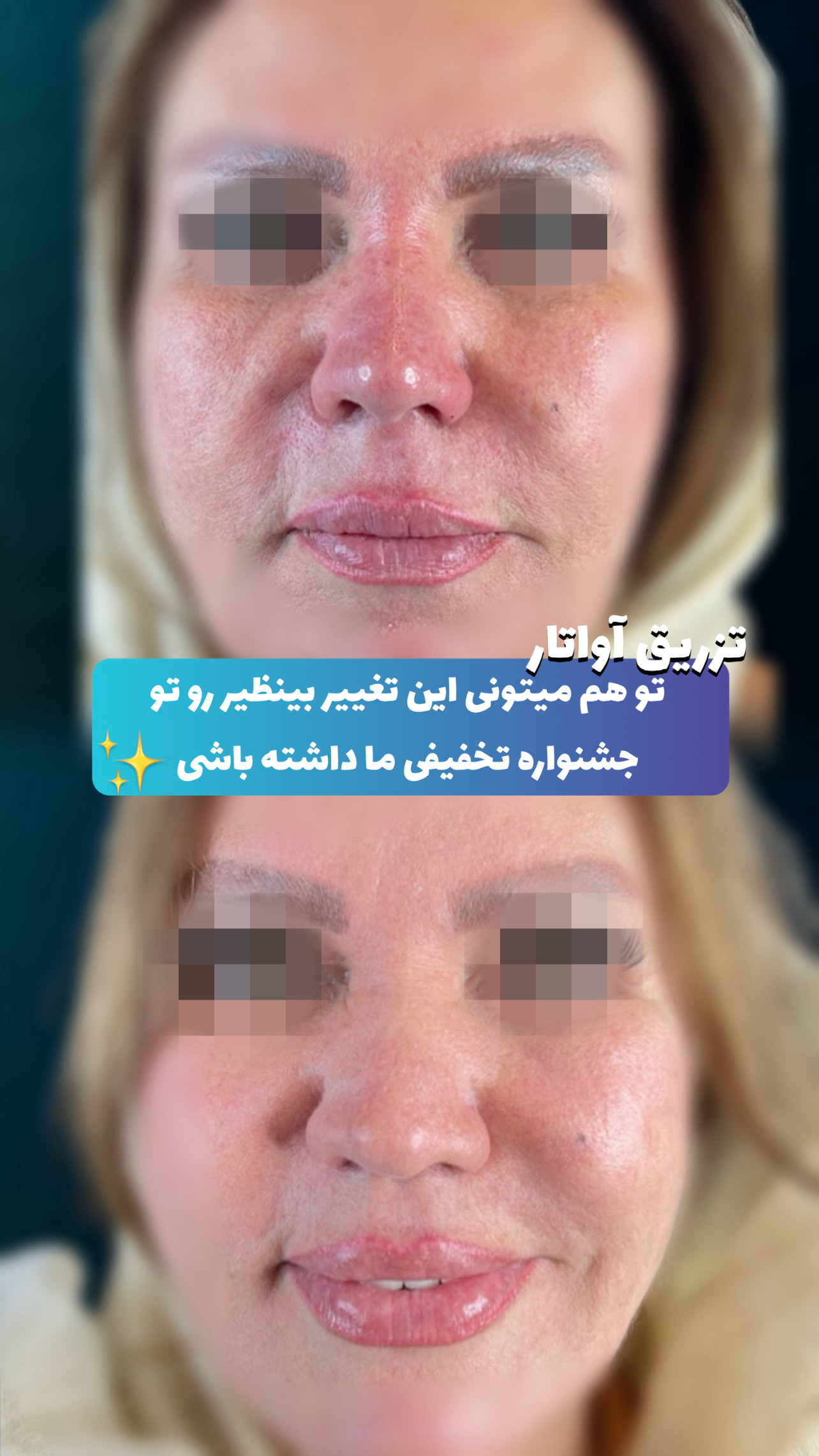 گالری آواتار بینی - تصویر 19