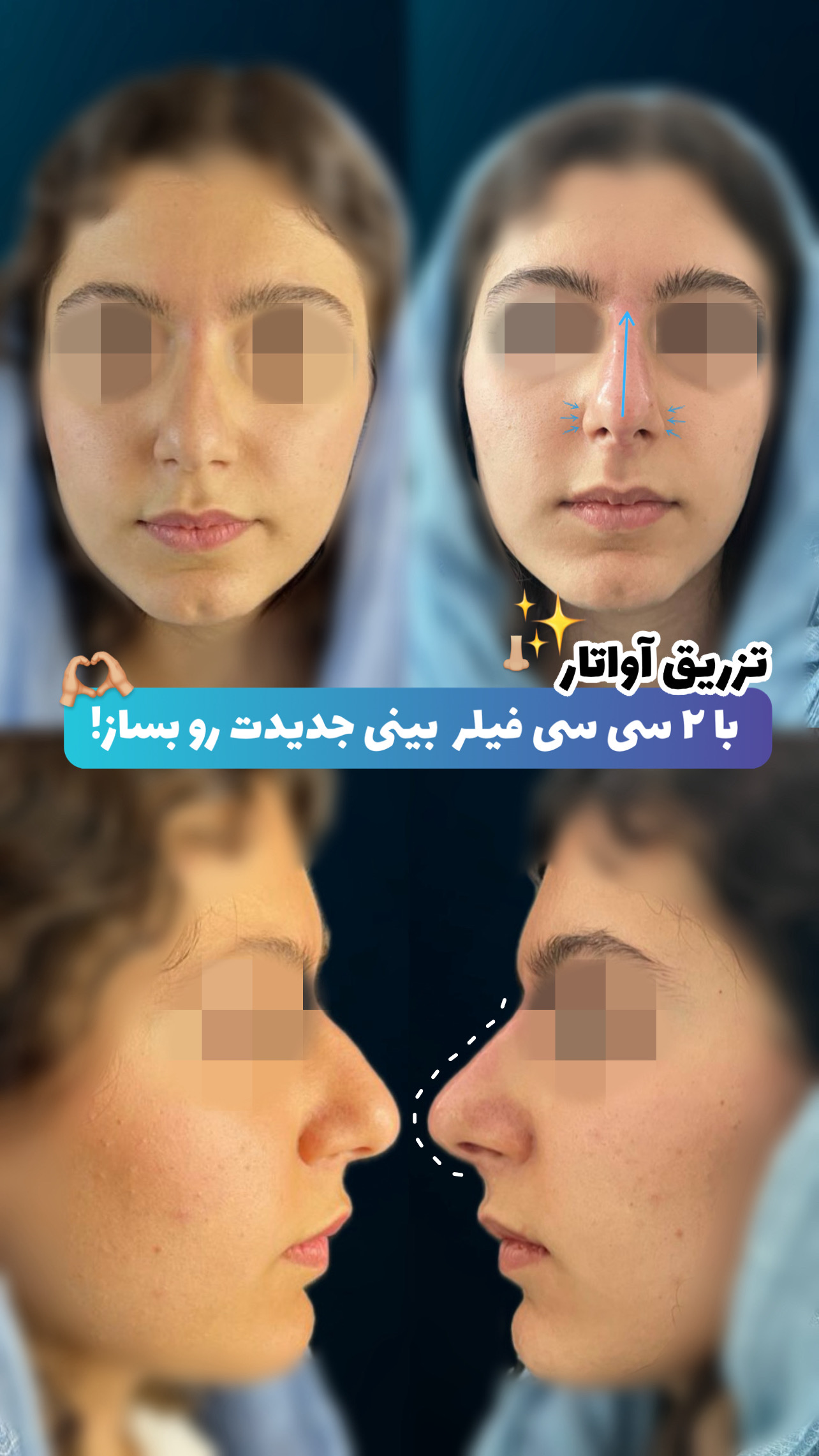 گالری آواتار بینی - تصویر 20