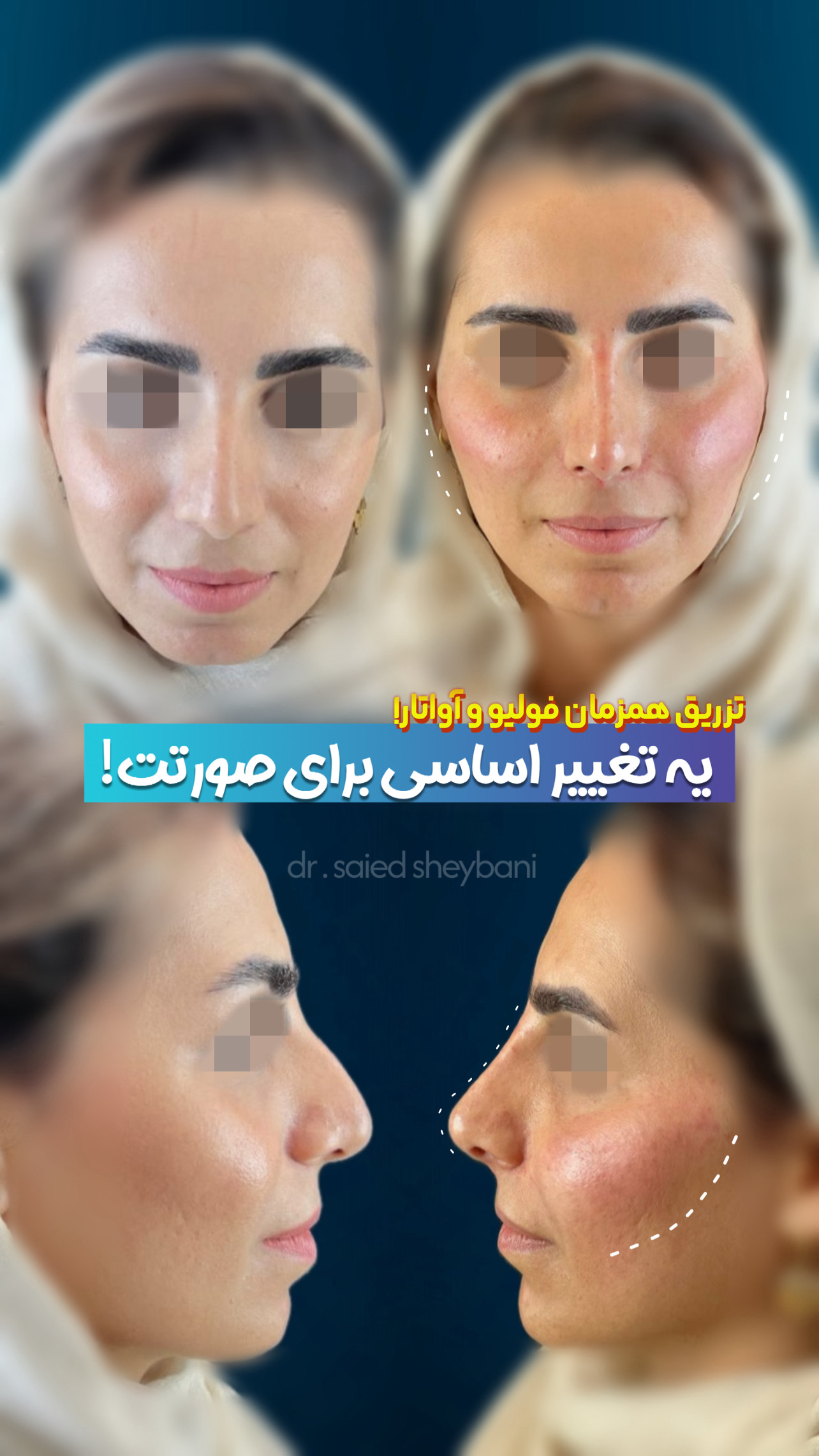 گالری آواتار بینی - تصویر 22