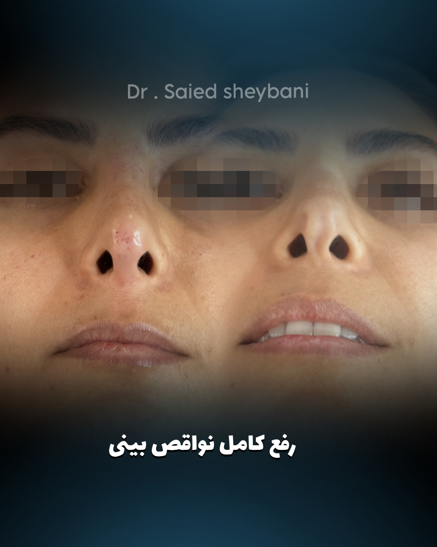 گالری آواتار بینی - تصویر 24