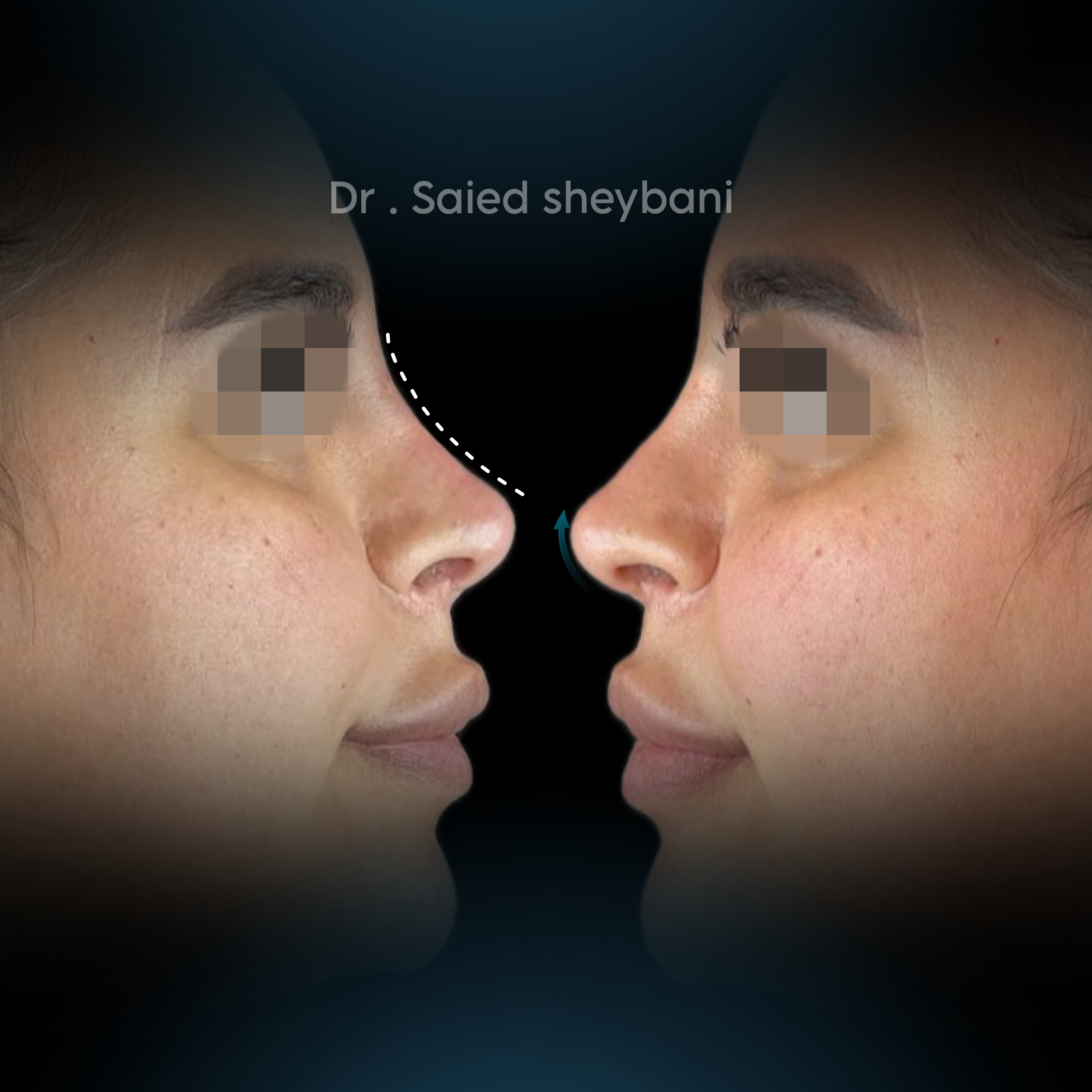 گالری آواتار بینی - تصویر 12