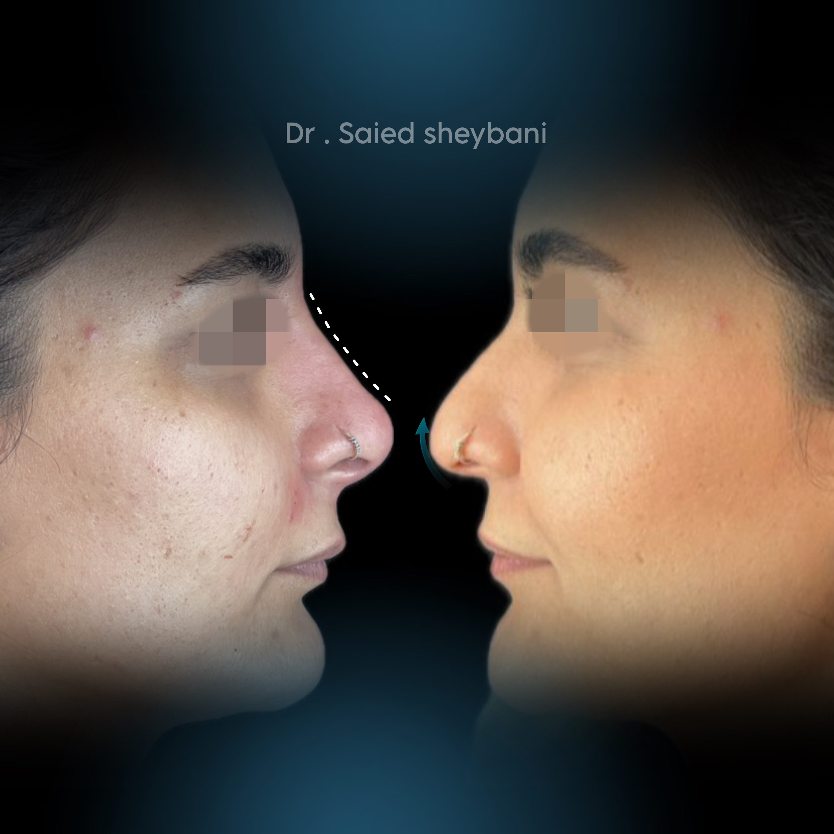 گالری آواتار بینی - تصویر 2