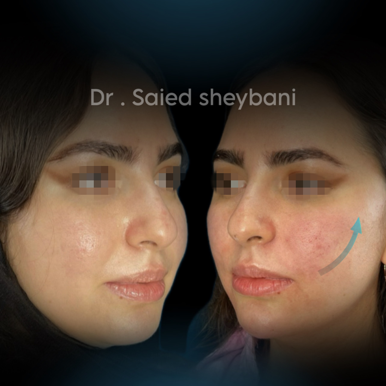 گالری Folio Lift - تصویر 2