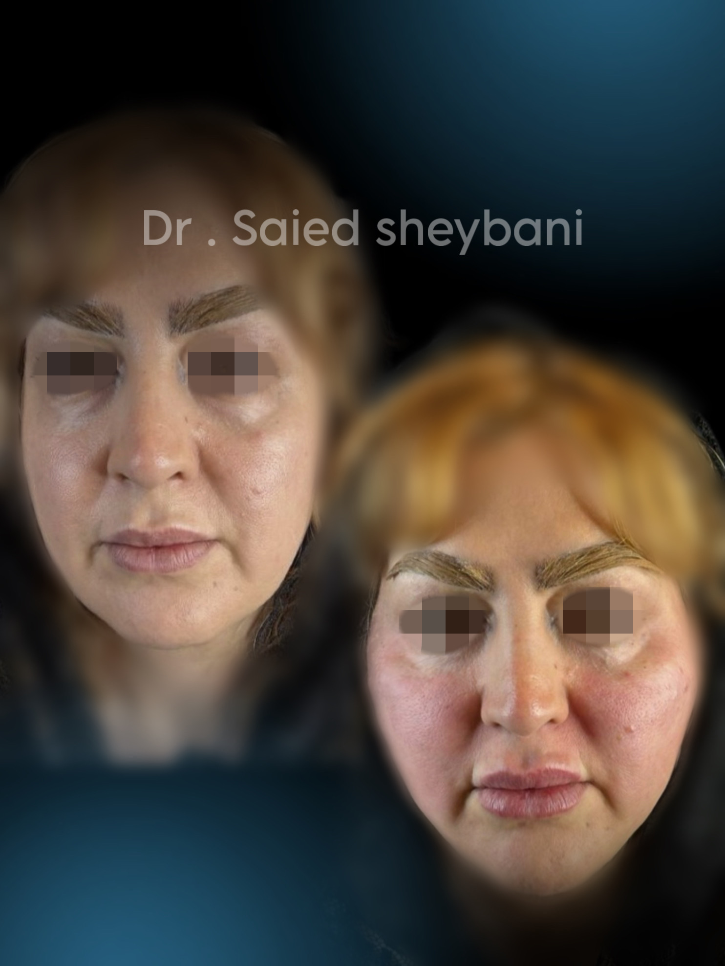 گالری Folio Lift - تصویر 3