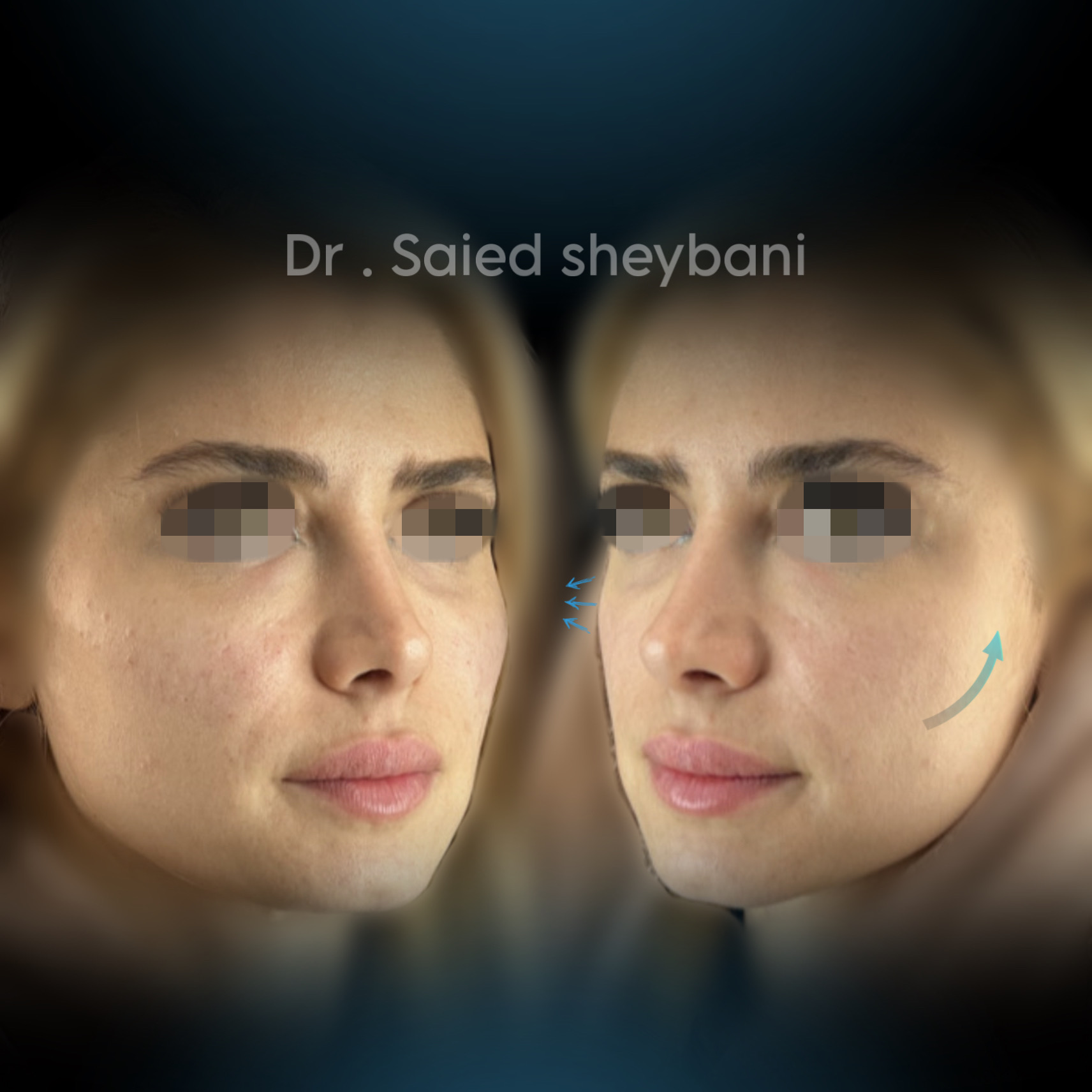 گالری Folio Lift - تصویر 4