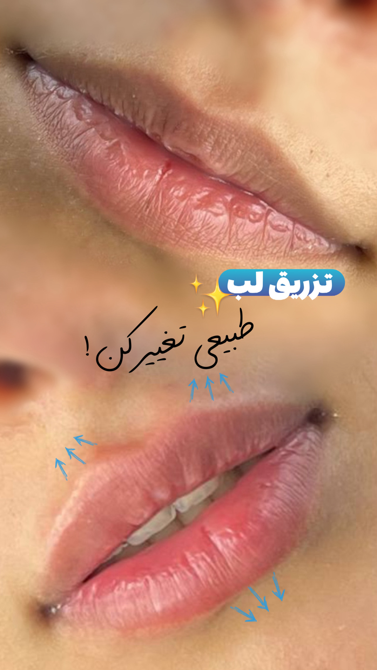 گالری Lattes Lip - تصویر 1