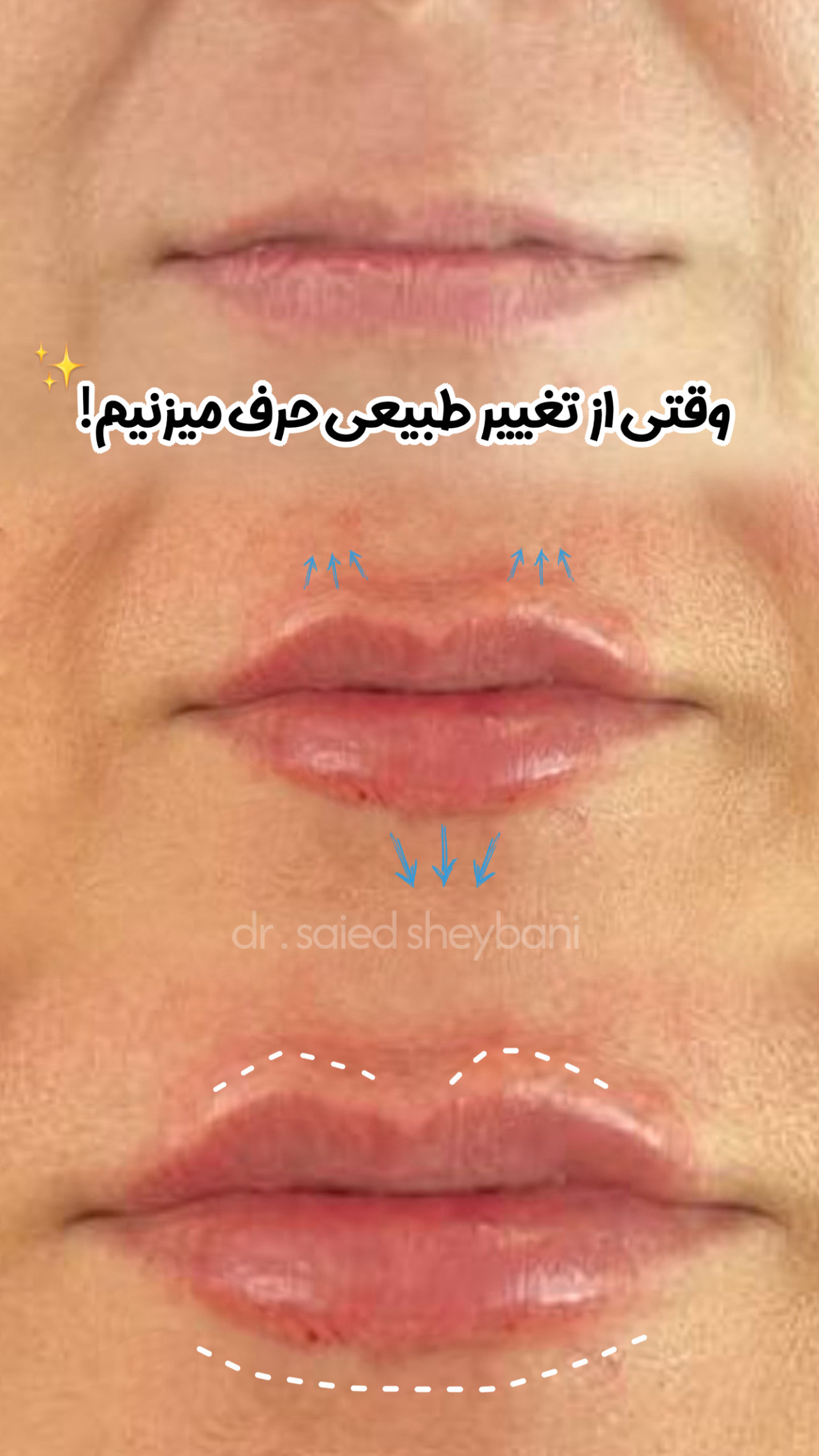 گالری Lattes Lip - تصویر 2